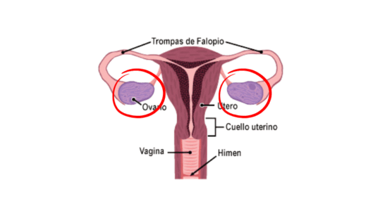 Cáncer de ovario