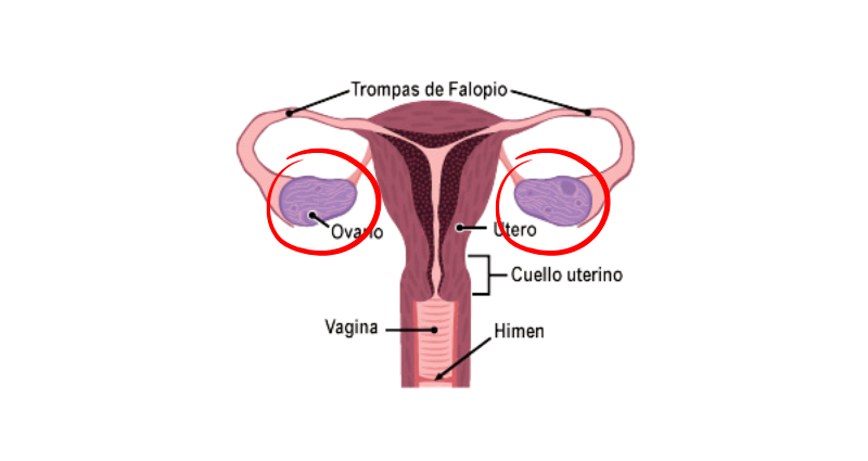 Cáncer de ovario